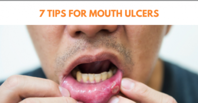 7 Tips For Mouth Ulcers Dental Blog Aeshetic Smiles